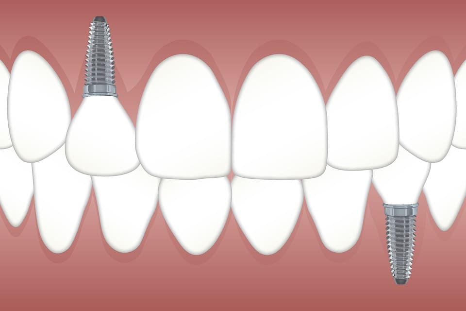 découvrez l'interprétation des rêves impliquant un dentiste selon la perspective islamique, et comprenez la signification spirituelle et symbolique de ces rêves.